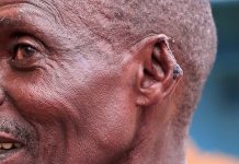 65-year-old man attacked by daughter-in-law in Rwinkwavu over family conflict