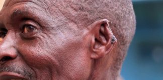 65-year-old man attacked by daughter-in-law in Rwinkwavu over family conflict